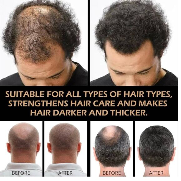 Root Activator Shampoo– Anti Hair Loss Treatment With Natural Regrowth Formula - Picture 3 of 6